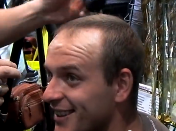 Watch This Bald Man Grow Hair In A Matter Of Seconds