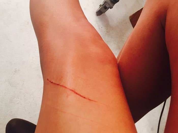 Taylor Swift says pet cat Meredith owes her $40 million after scratching her leg