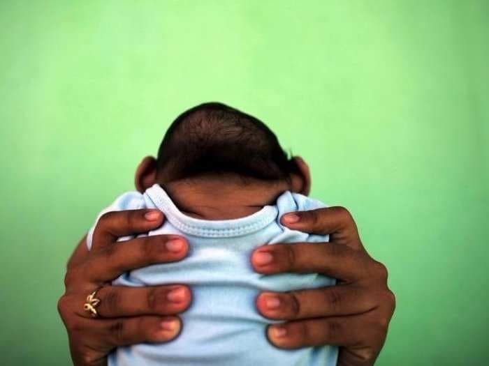 It's official: Zika is a cause of birth defects including microcephaly