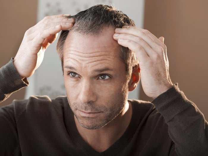 The only 4 things that can actually prevent hair loss