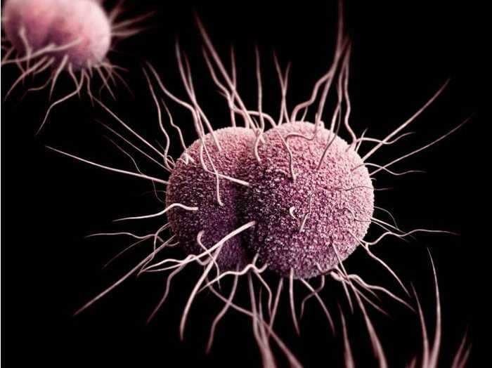 A 'super gonorrhea' vaccine is being developed by the team behind AstraZeneca's COVID-19 shot