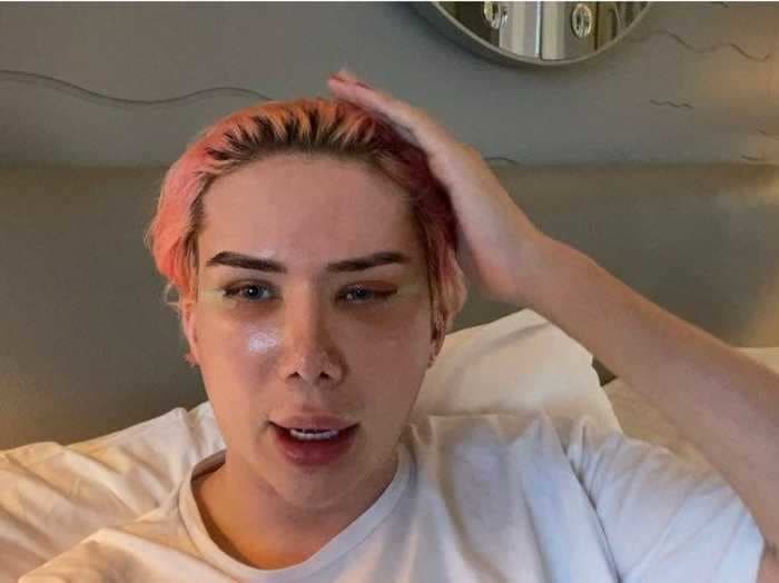 Oli London, the Rachel Dolezal of South Korean pop culture, doubles down on transracial claims while showing off their new surgery-enhanced eyes