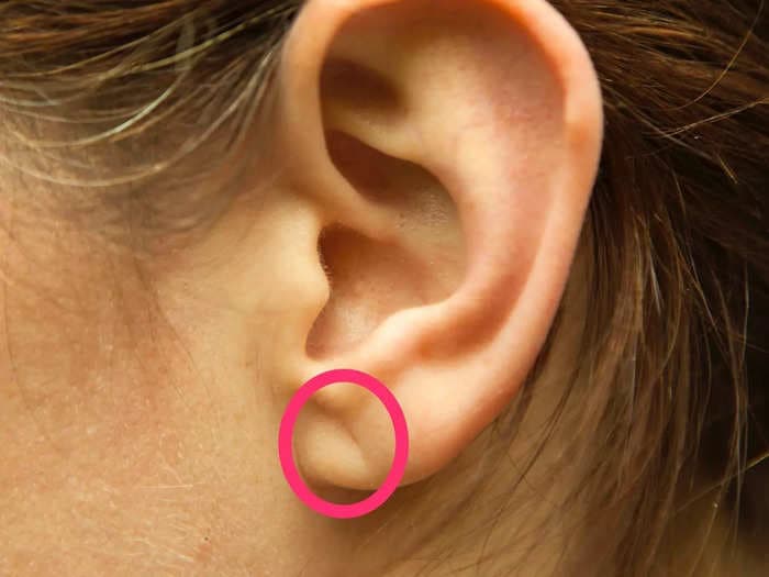 An earlobe crease may predict heart disease for people under 40 — here's what to look for
