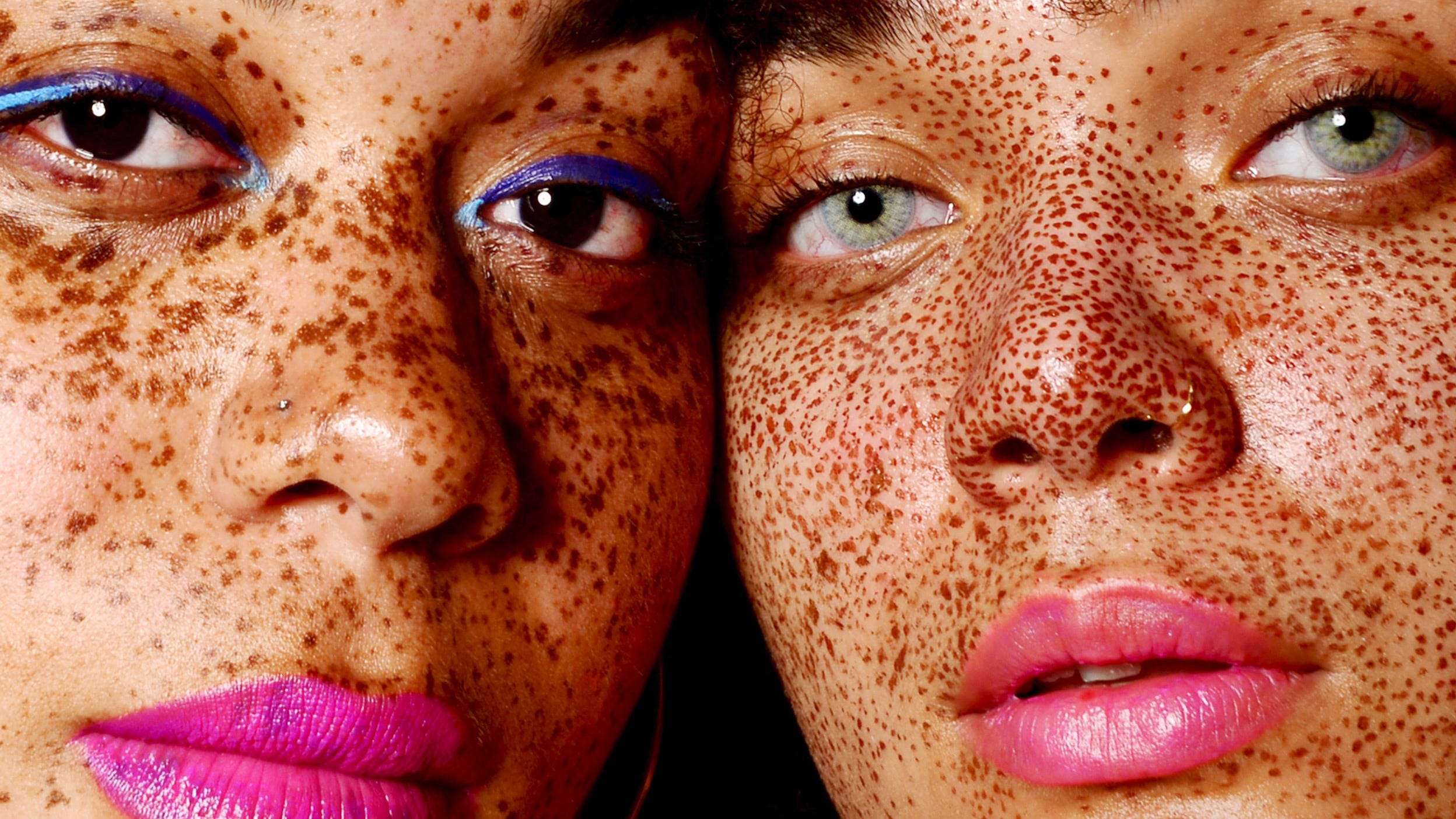 Ever wonder what causes freckles? Here's how they form ...