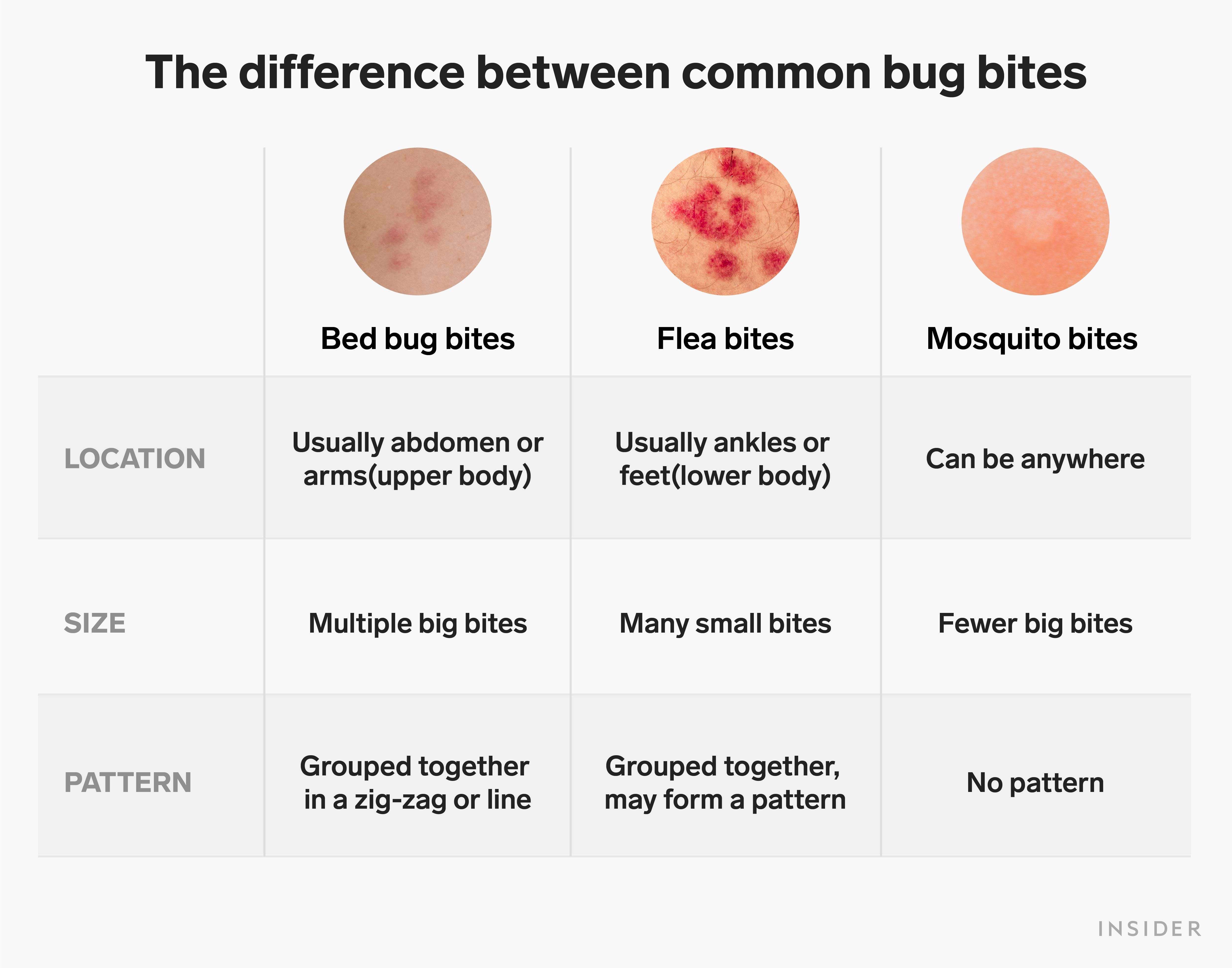 bed bug vs flea bites