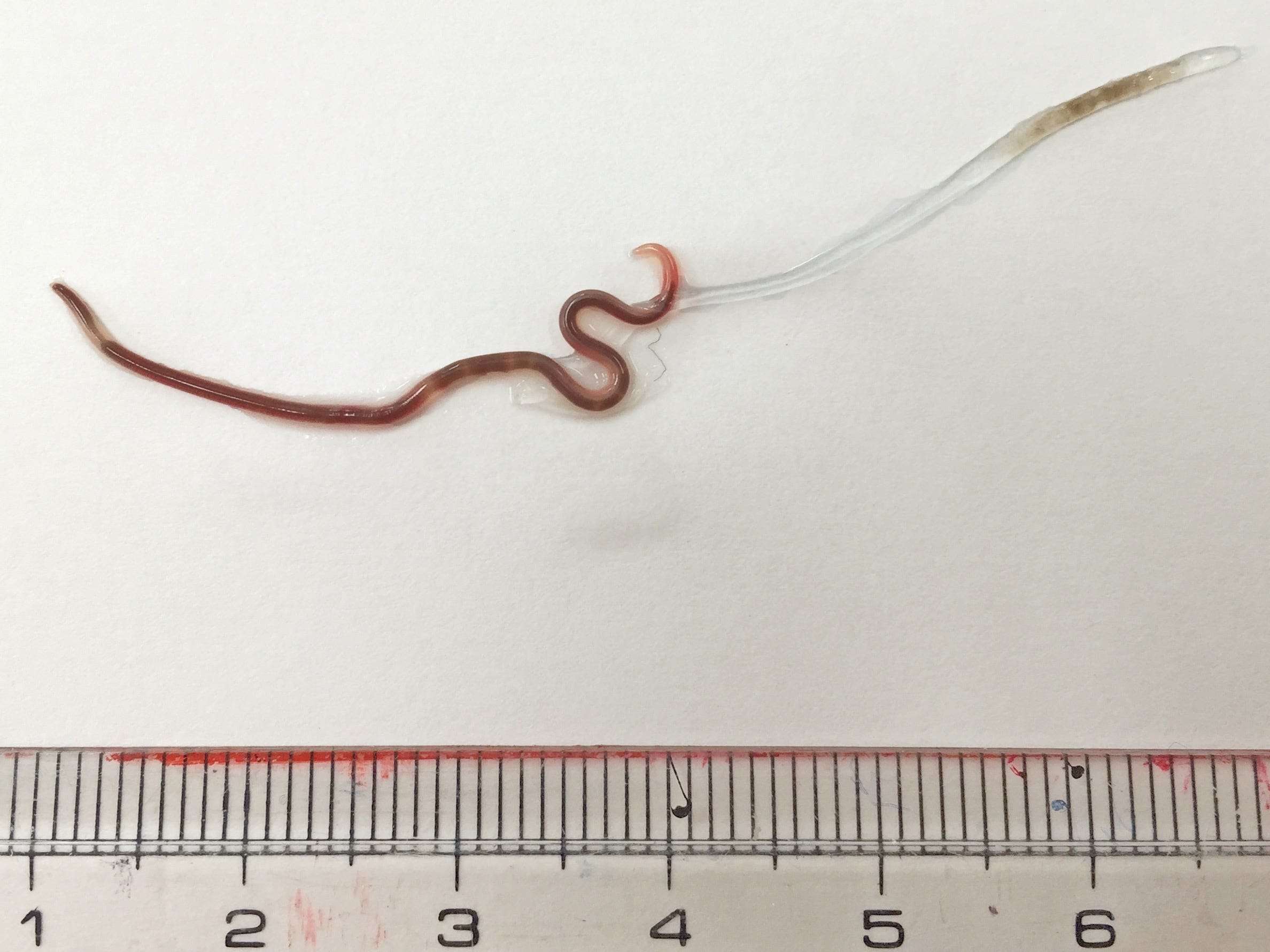 Doctors found a worm in a woman's tonsil after she ate sashimi ...