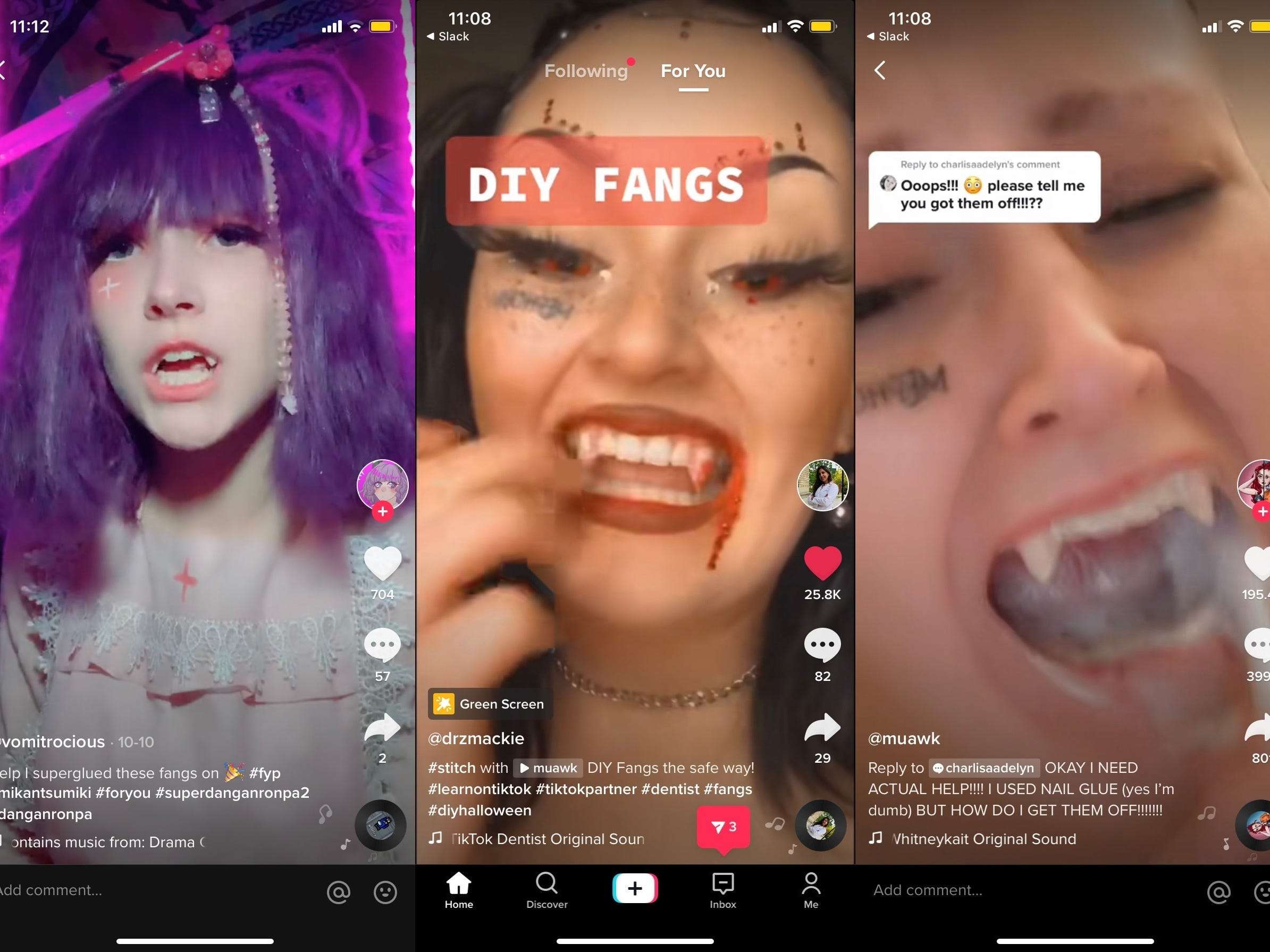 Tiktok Users Are Super Gluing Vampire Fangs To Their Teeth And Struggling To Get Them Off Dentists Are Not Happy About It Business Insider India