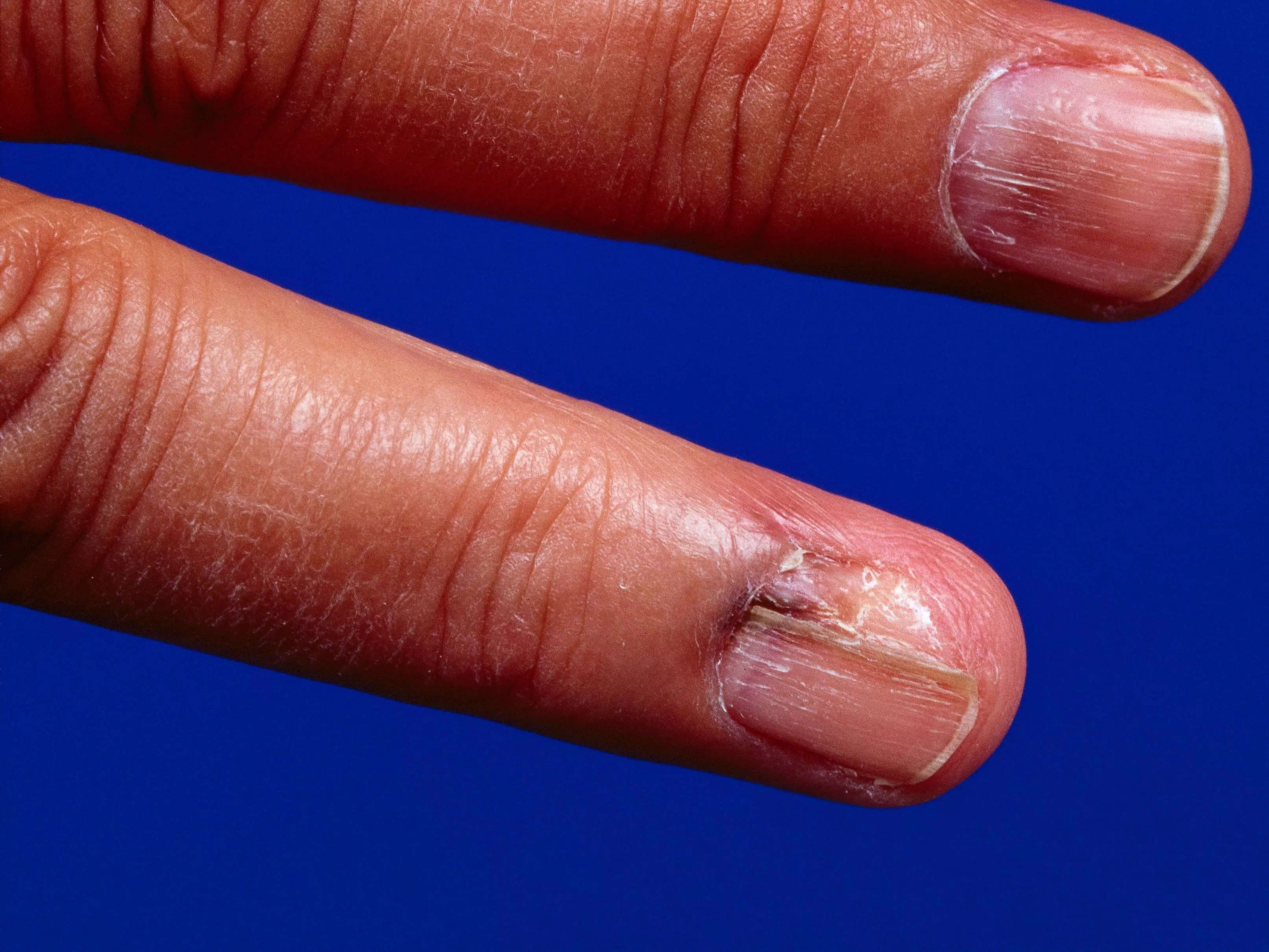 Nail Art Tutorial: Snakeskin Effect Nails | Nailpro