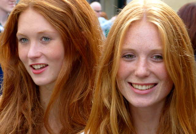 8. The Link Between Red Hair and Freckles - wide 2