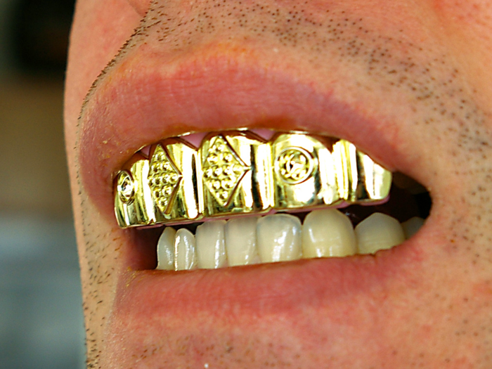 Full set of 18k gold teeth
