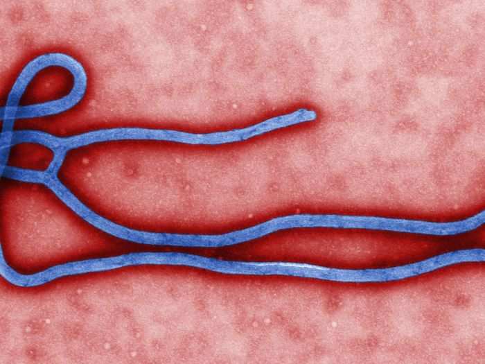 The Ebola virus, which under a microscope resembles spaghetti, is thought to come from a fruit bat bite. There are five types of the virus, and four of them can make humans severely ill.
