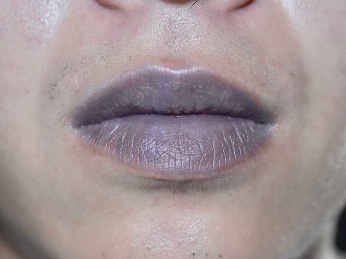 Bluish skin or lips are signs of a serious infection, since they signal a lack of oxygen in the blood.