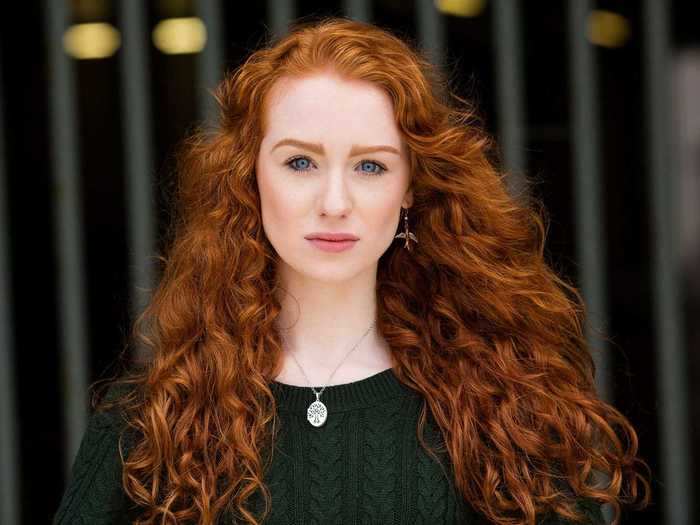 Photographer Brian Dowling has always appreciated the uniqueness of red hair.