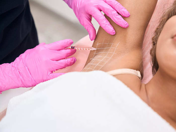 Botox in your armpits is a common treatment for excessive sweating.